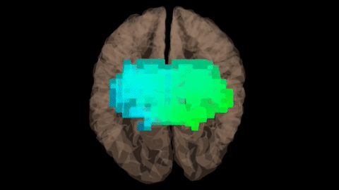 Dr Fannin study of Access Bars — brain scan movie after Bars