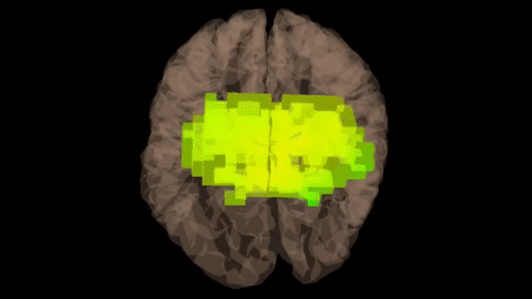 Dr Fannin study of Access Bars — brain scan movie before Bars